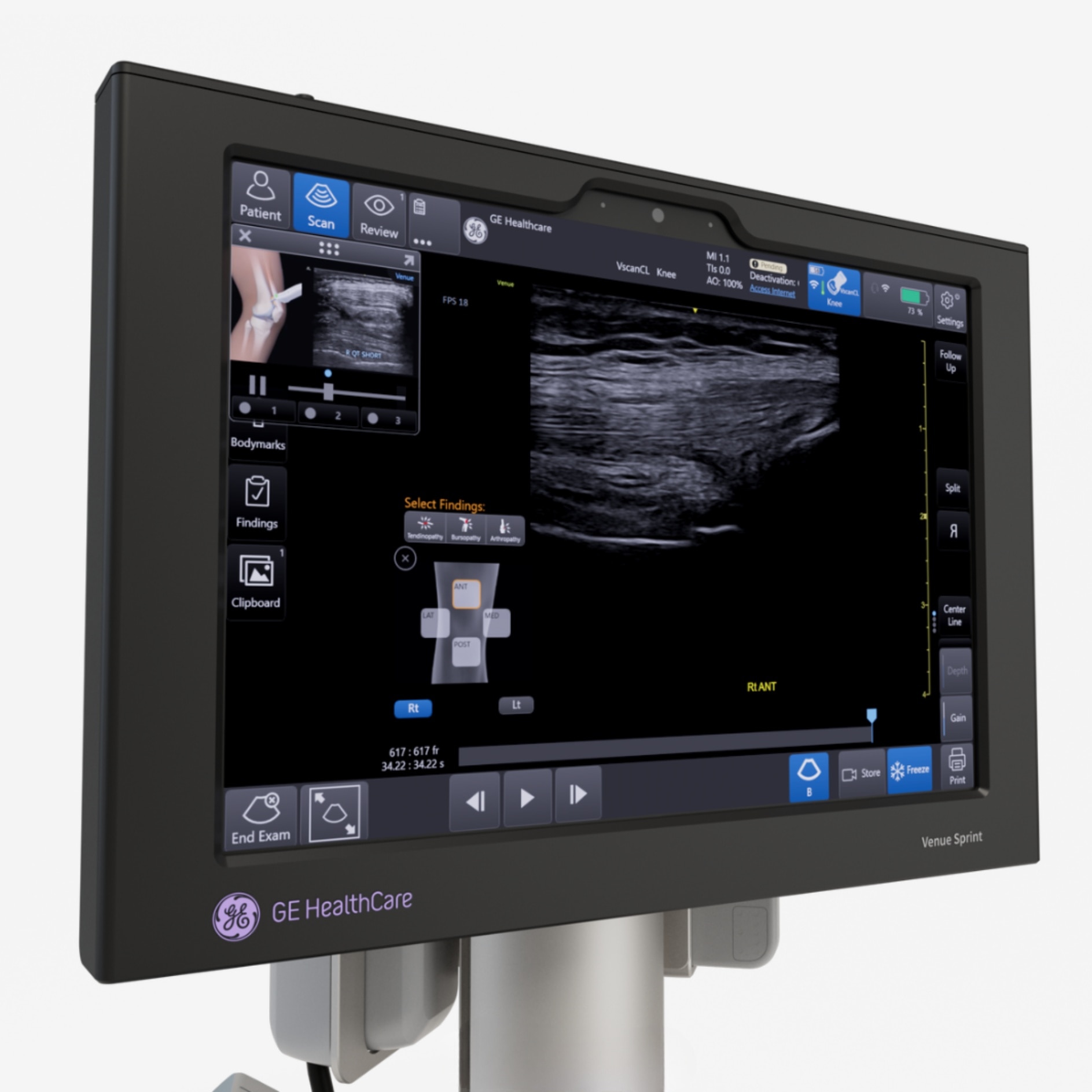 Vscan Extend Sector R2 Vscan Extend Sector R2