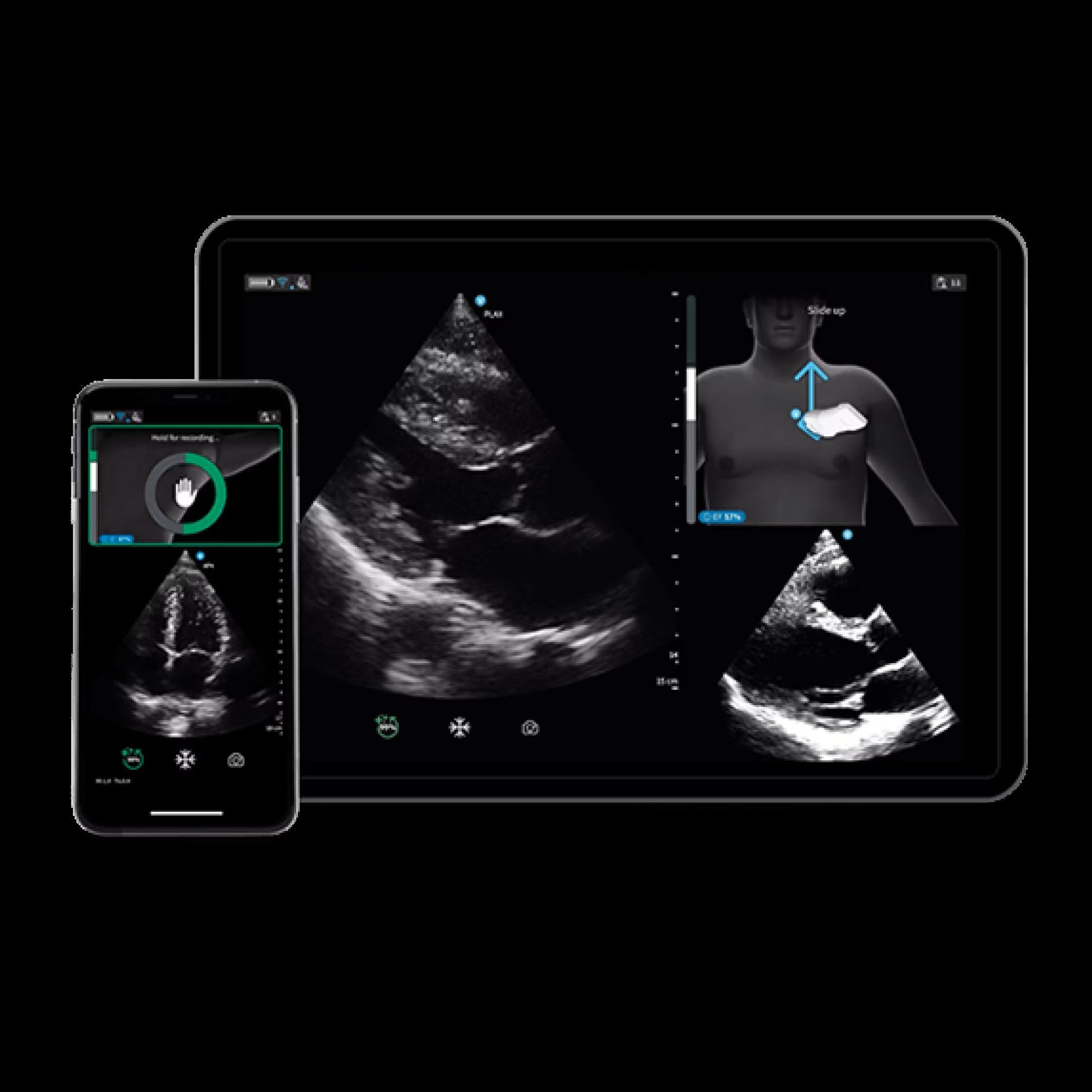 Vscan Air IB Offering Vscan Air IB Offering
