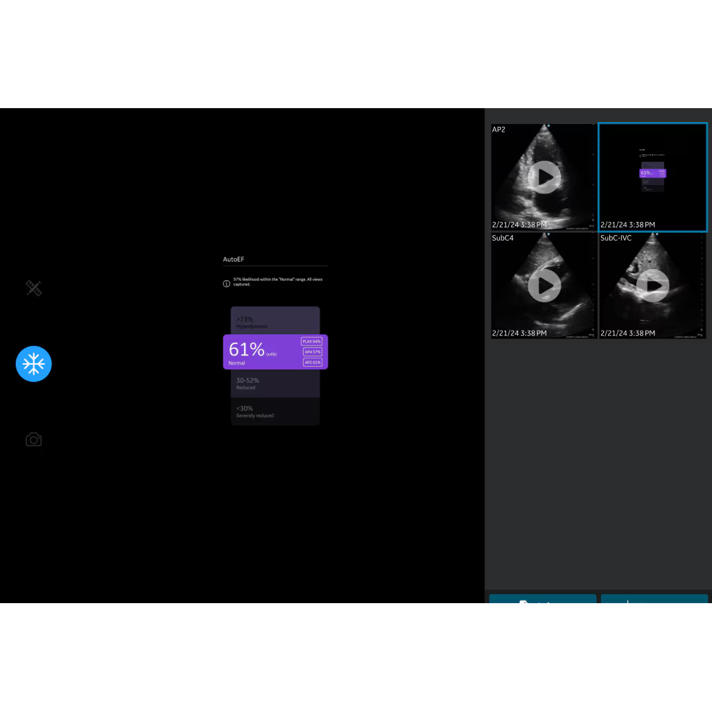 Vscan Air IB Offering Vscan Air IB Offering