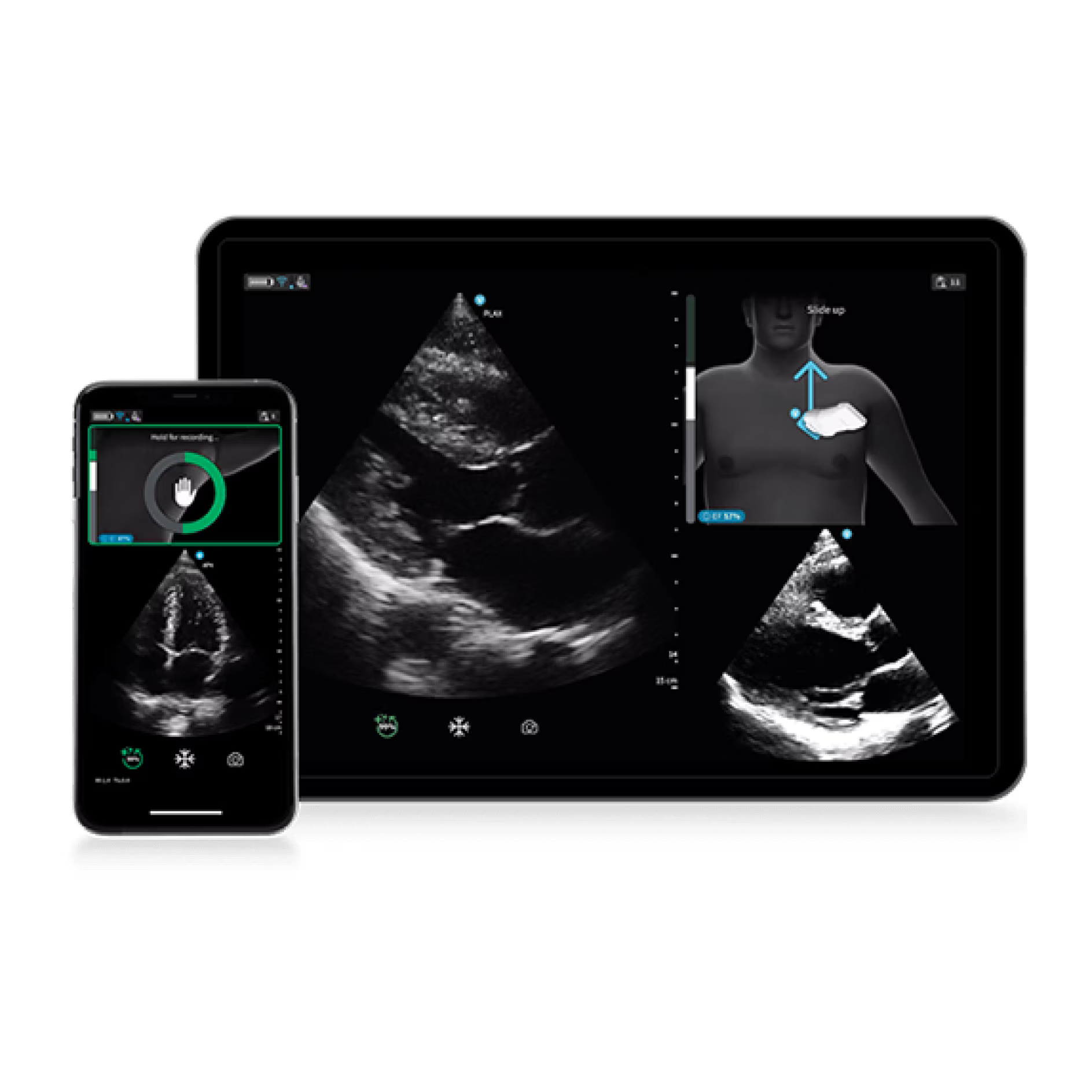 Vscan Air IB Offering Vscan Air IB Offering