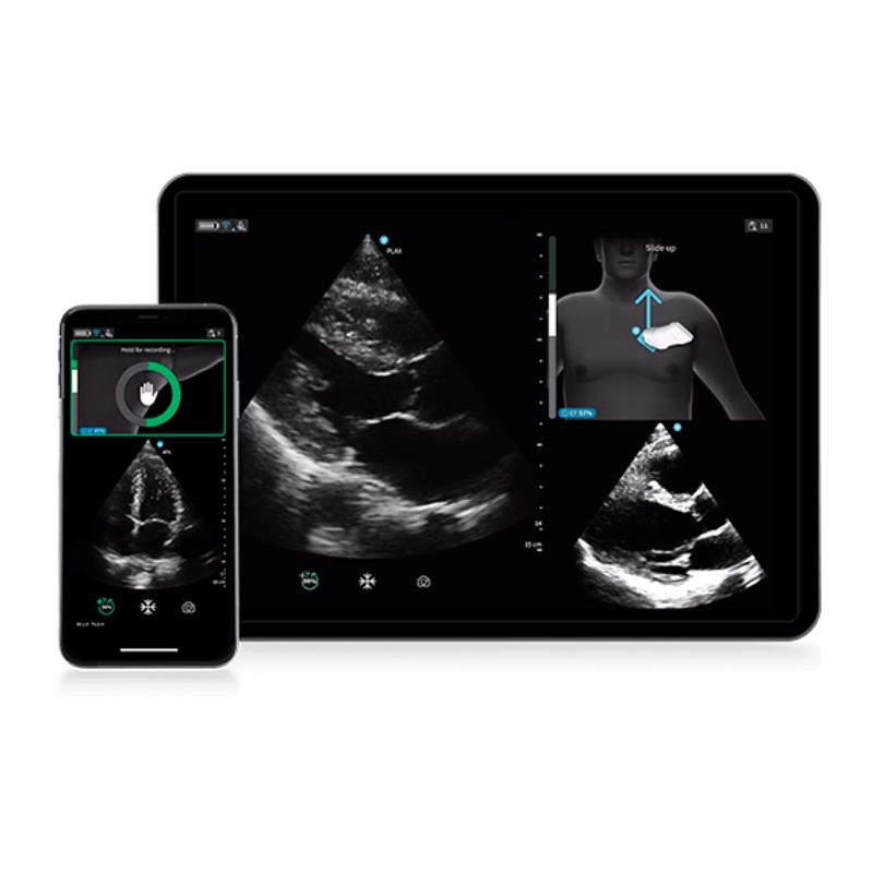 Caption AI™ for Vscan Air™ SL