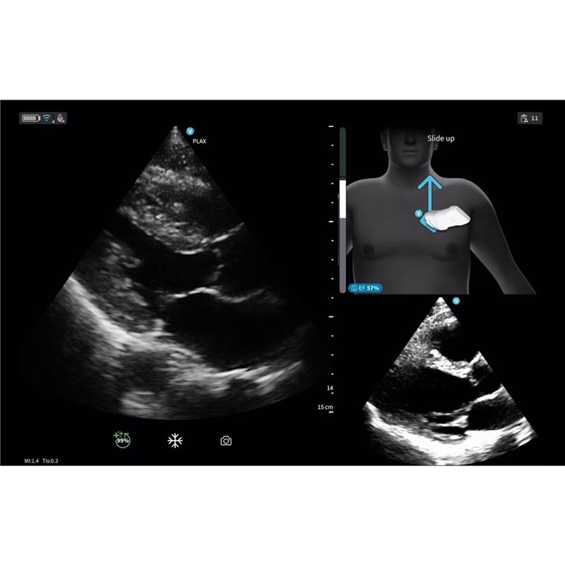 Caption AI™ for Vscan Air™ SL