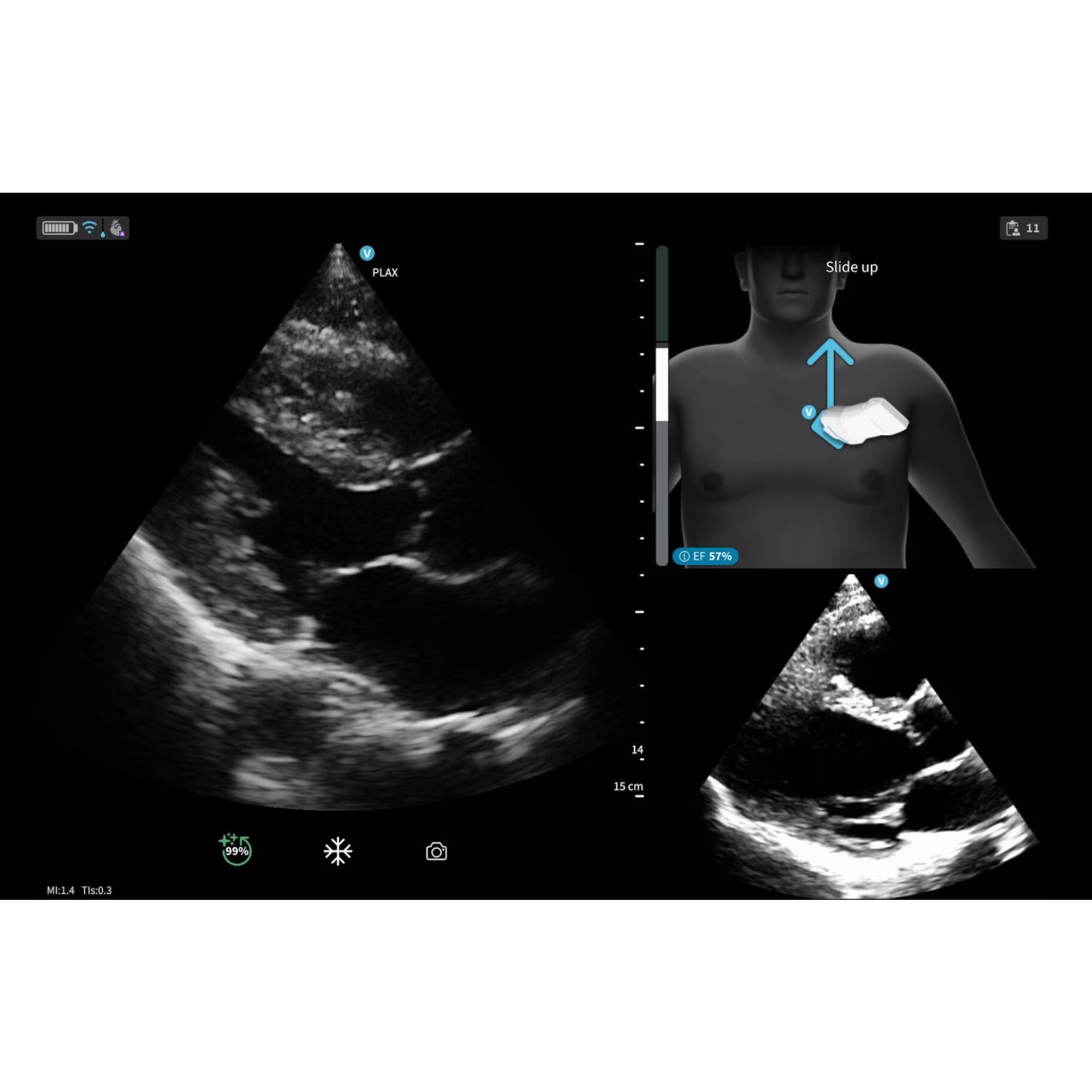 Vscan Air IB Offering Vscan Air IB Offering
