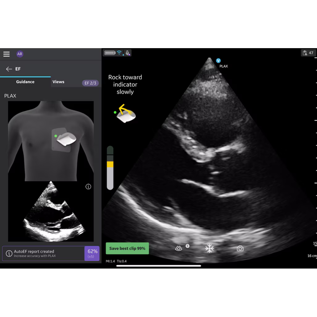 Vscan Air IB Offering Vscan Air IB Offering