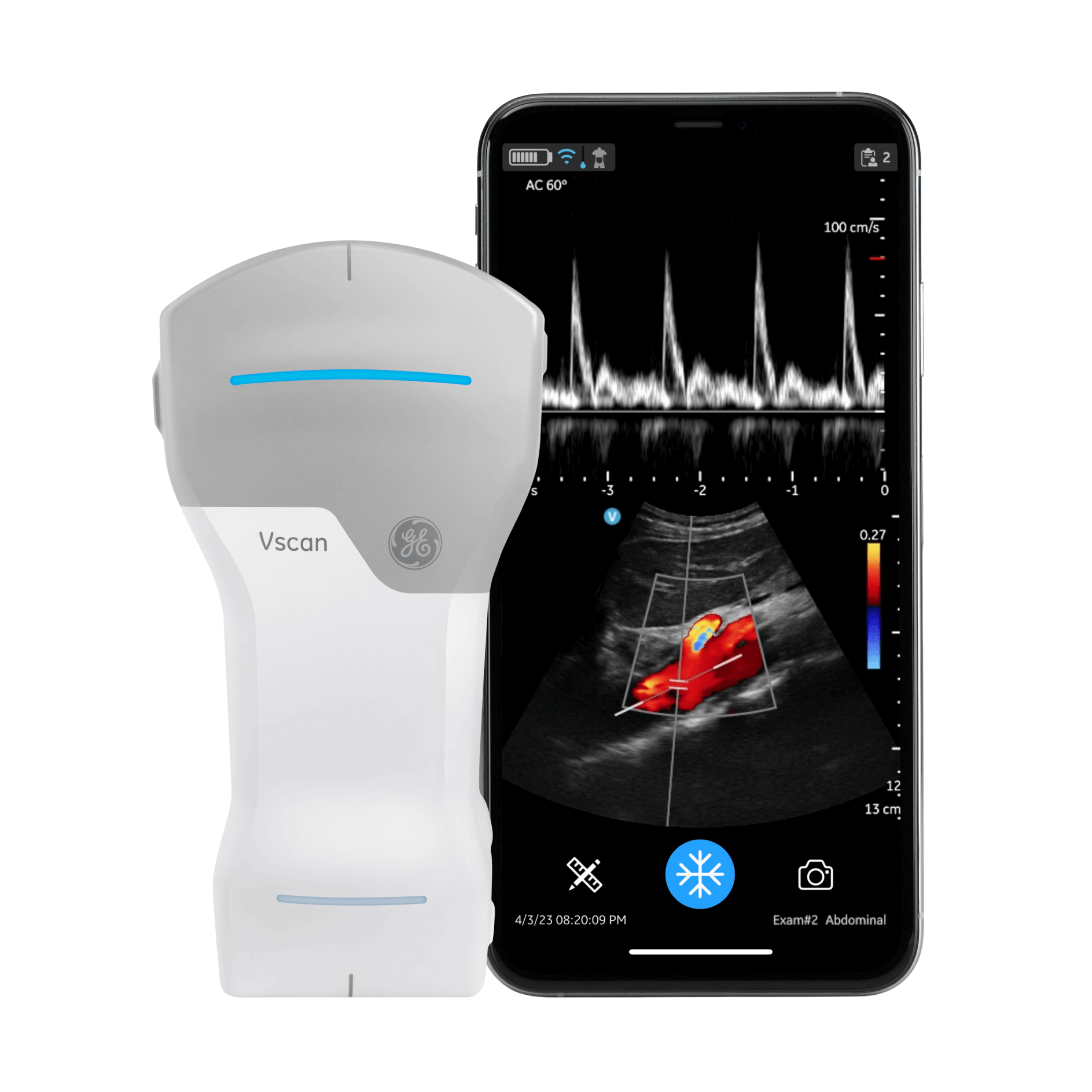 EchoPAC SoftwareOnly v206 EchoPAC SoftwareOnly v206