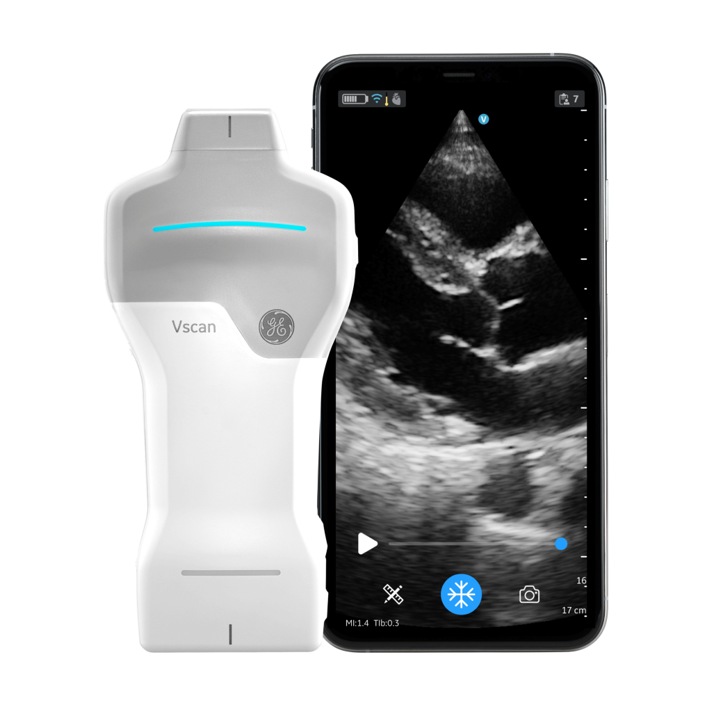 Vscan Air™ SL R3