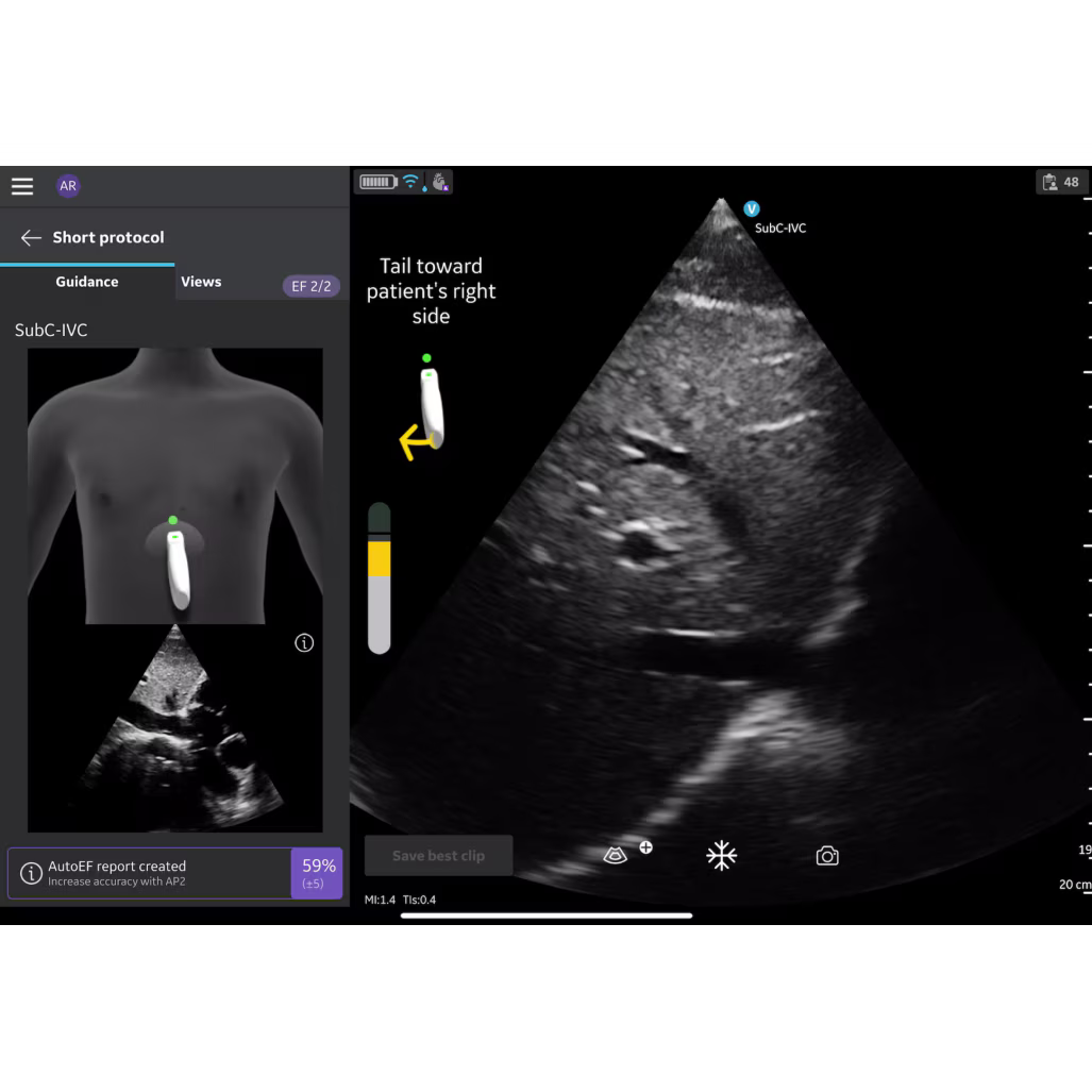 Vscan Air IB Offering