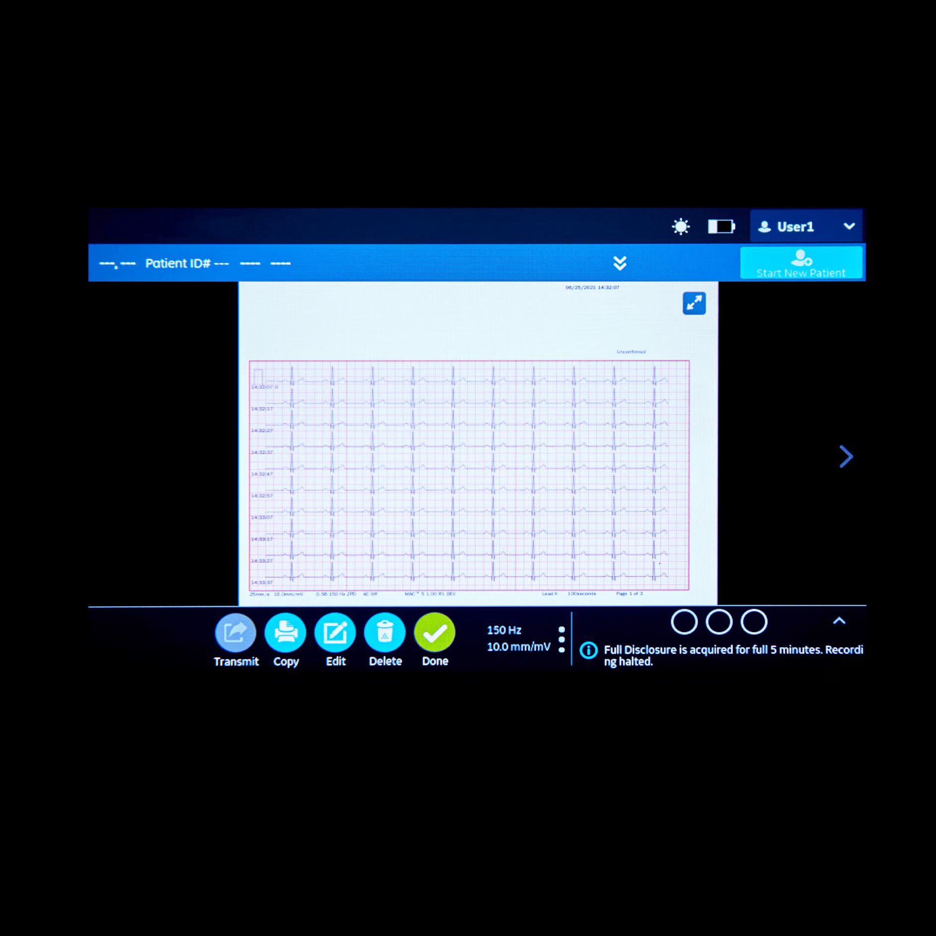 Vscan Extend Dual R2 Vscan Extend Dual R2
