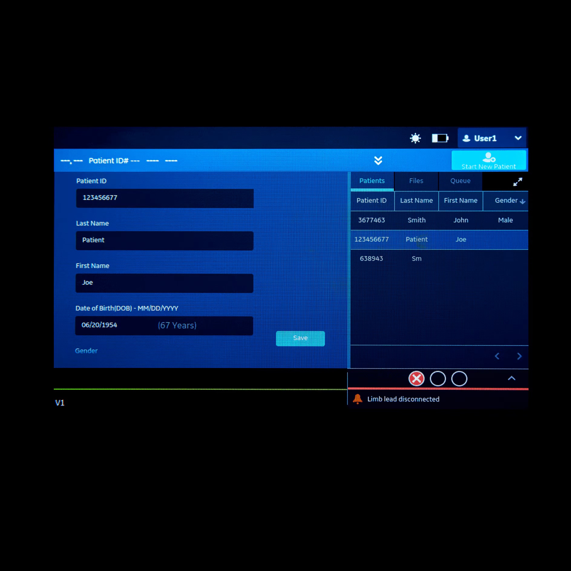 Vscan Extend Dual R2 Vscan Extend Dual R2