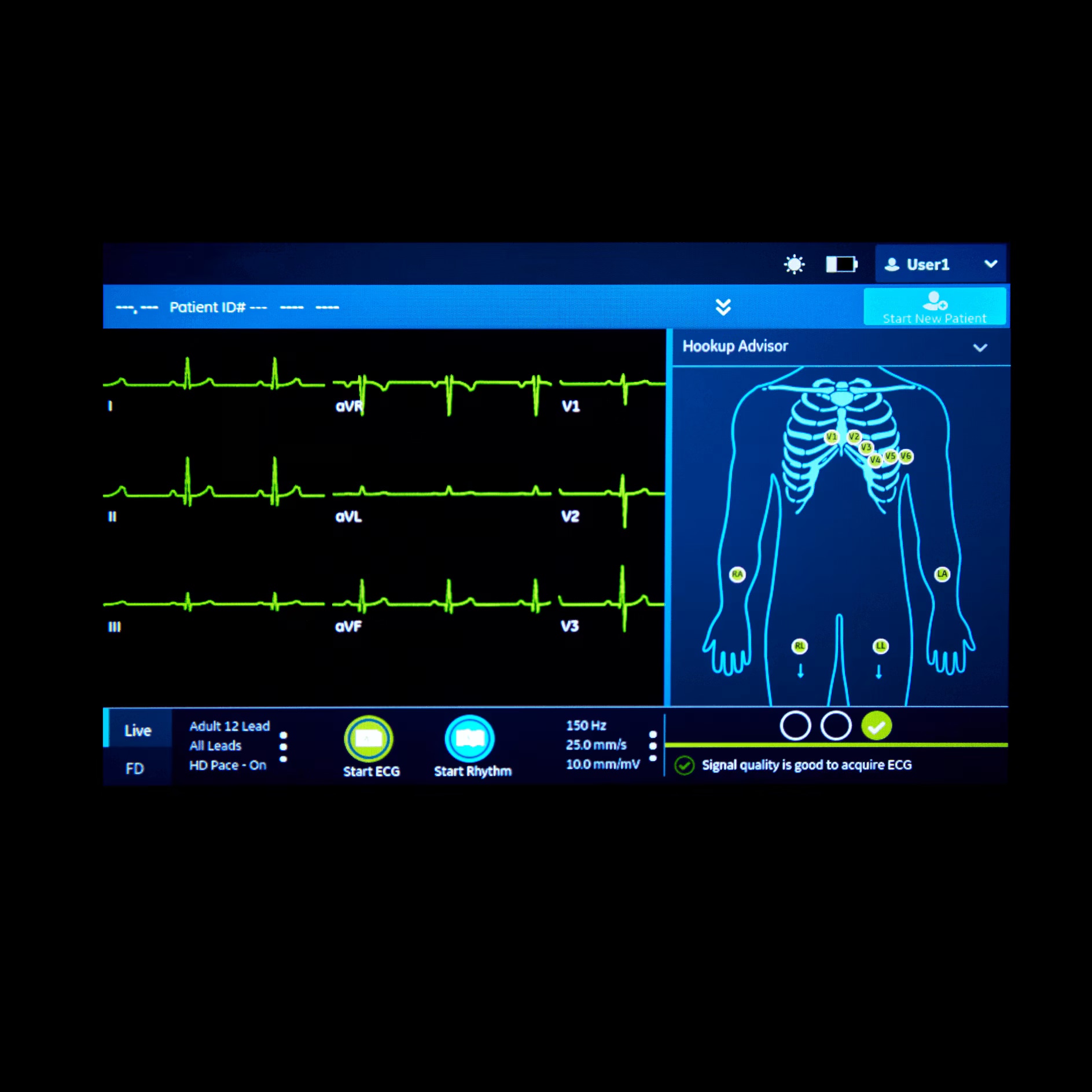 Vscan Extend Dual R2 Vscan Extend Dual R2